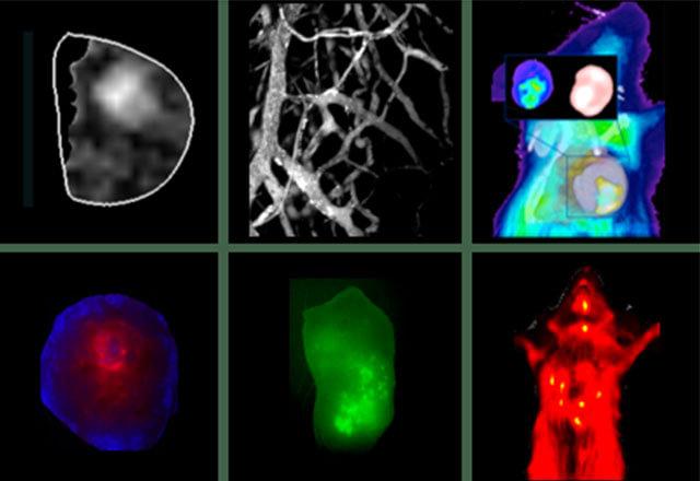 cancer imaging scan