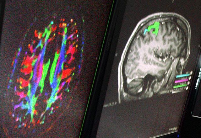 cardiac ct scan